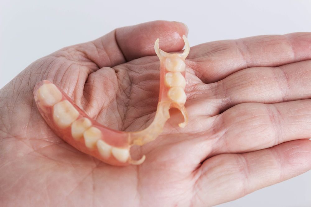 Traditional partial denture